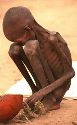 “Starving” – A Word You Should Never use Lightly